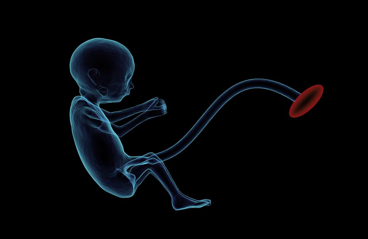 Fetus 1788082 1280